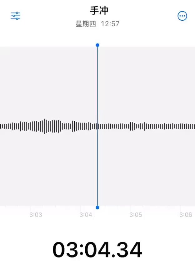 手好酸，有没有人帮我一下 