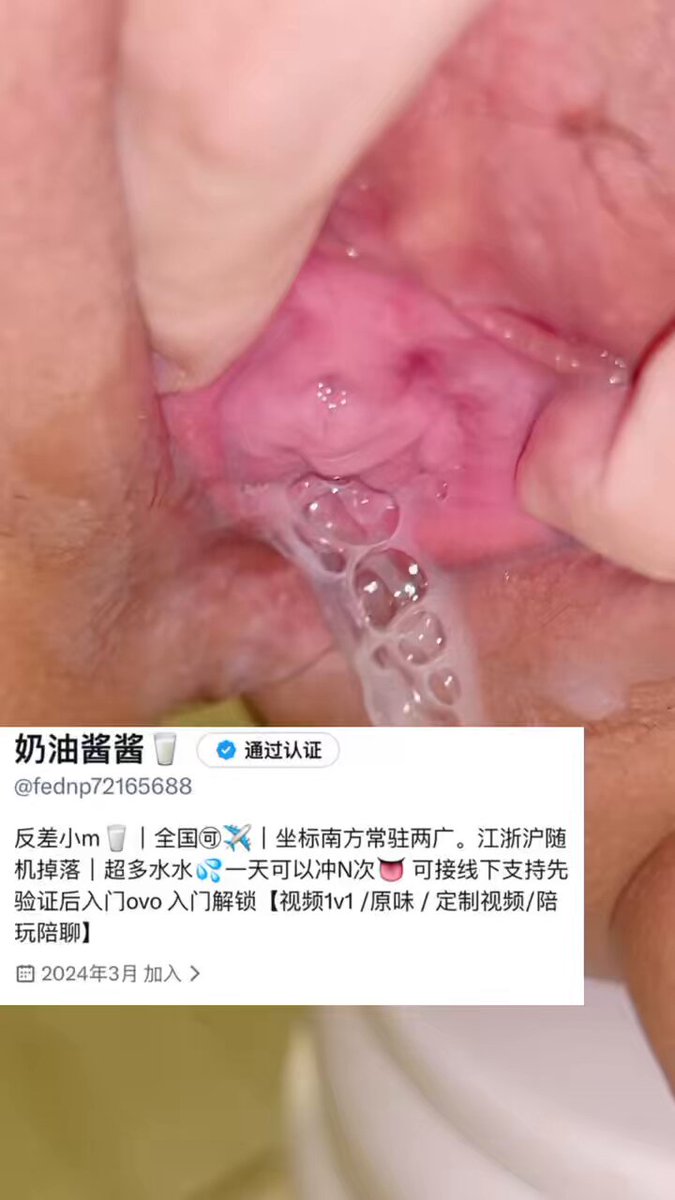 脱毛后嘟第一个视频ovo




 