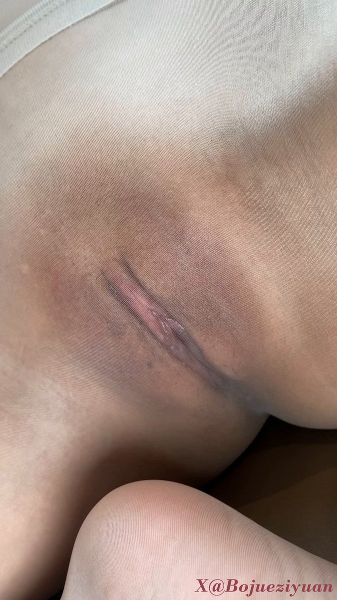 極上の産後マンコ接写！巨根の男が縫い目の陰唇を手で揉み、淫液が滴る — 123av.fun独占