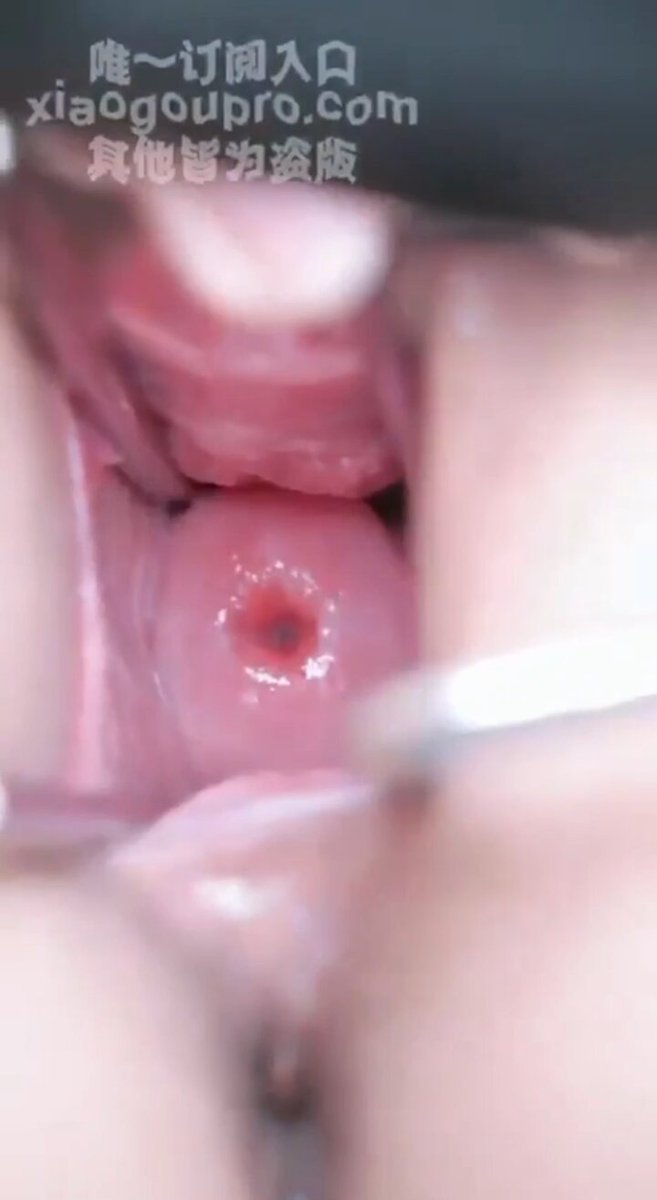Extreme Vaginal Dilation Close-Up! Duckbill Pliers Pry Open Pink Pussy, Inner Walls Fully Exposed