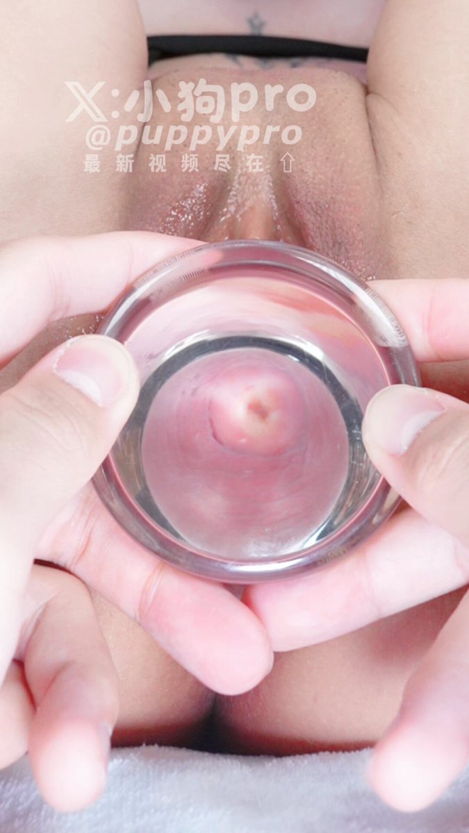 O êmbolo de vidro, com a espessura de um punho, mostrava claramente o vidro dilatando o esfíncter vaginal, chegando até o clitóris. O úte...